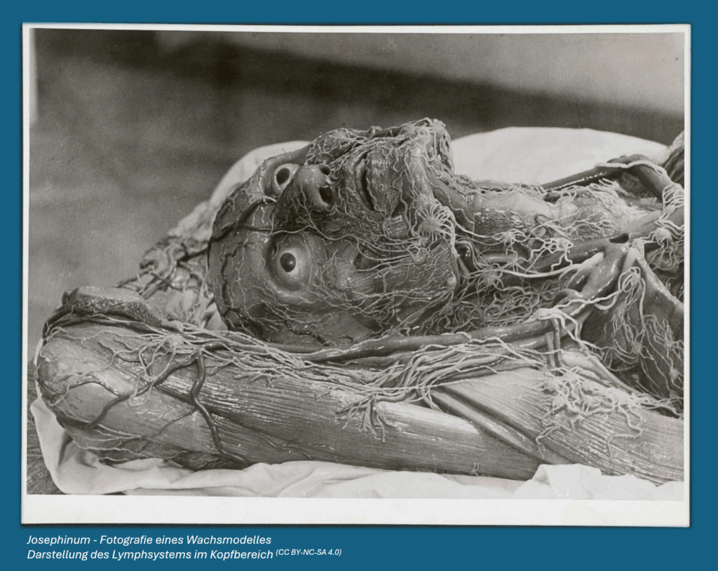 Josephinum - Fotografie eines Wachsmodelles Darstellung des Lymphsystems im Kopfbereich