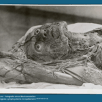 Josephinum - Fotografie eines Wachsmodelles Darstellung des Lymphsystems im Kopfbereich